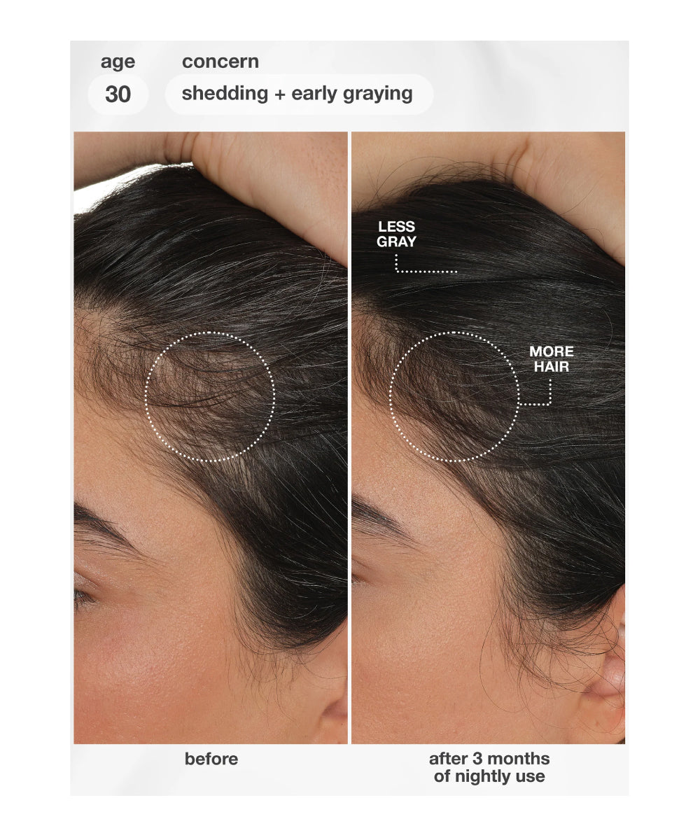 FutureIQ™ biomimetic hair longevity serum