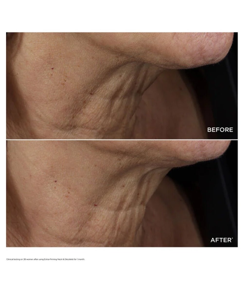 Extra-Firming Neck & Décolleté Anti-Aging Care