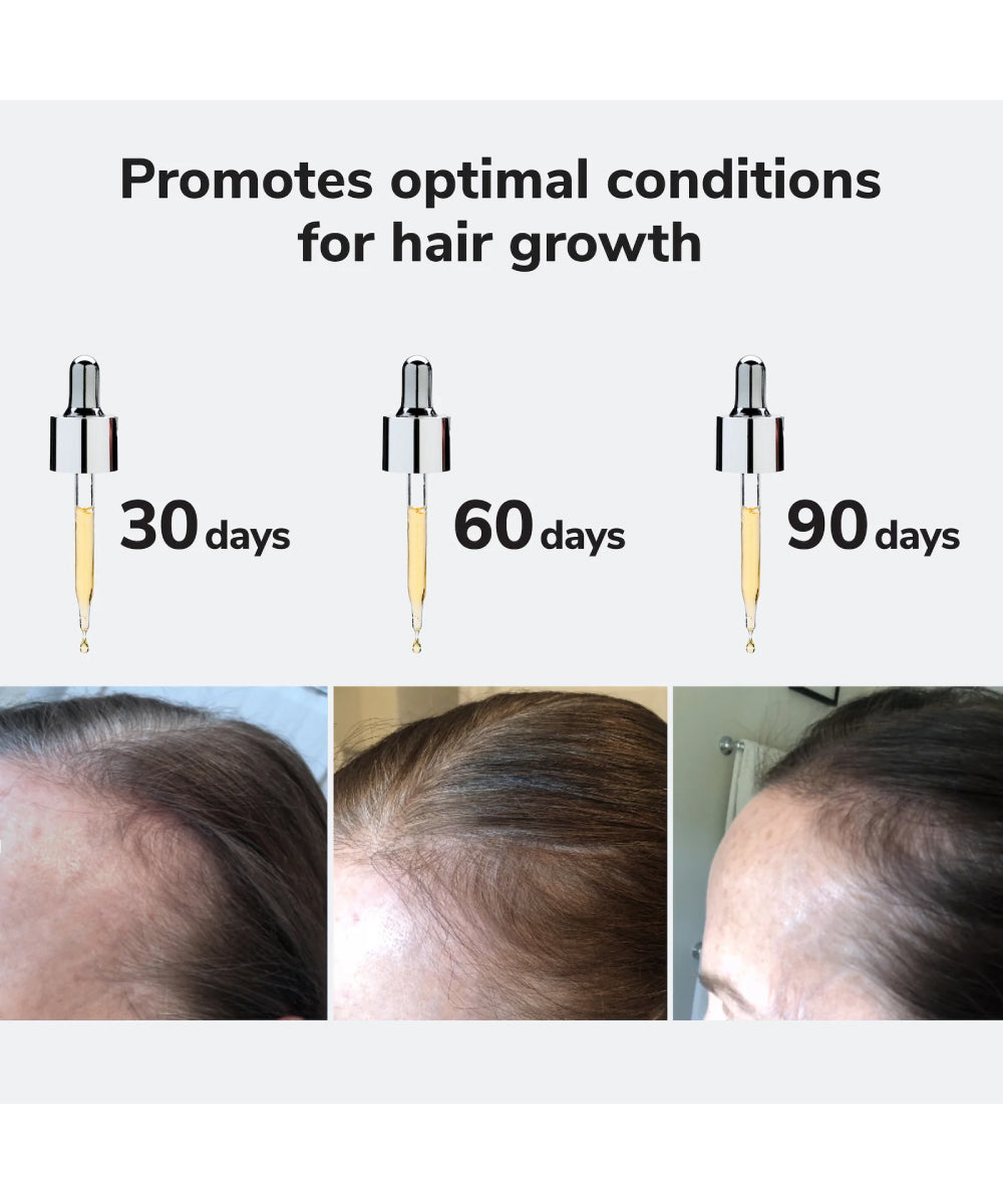 Youth Juice Scalp Treatment