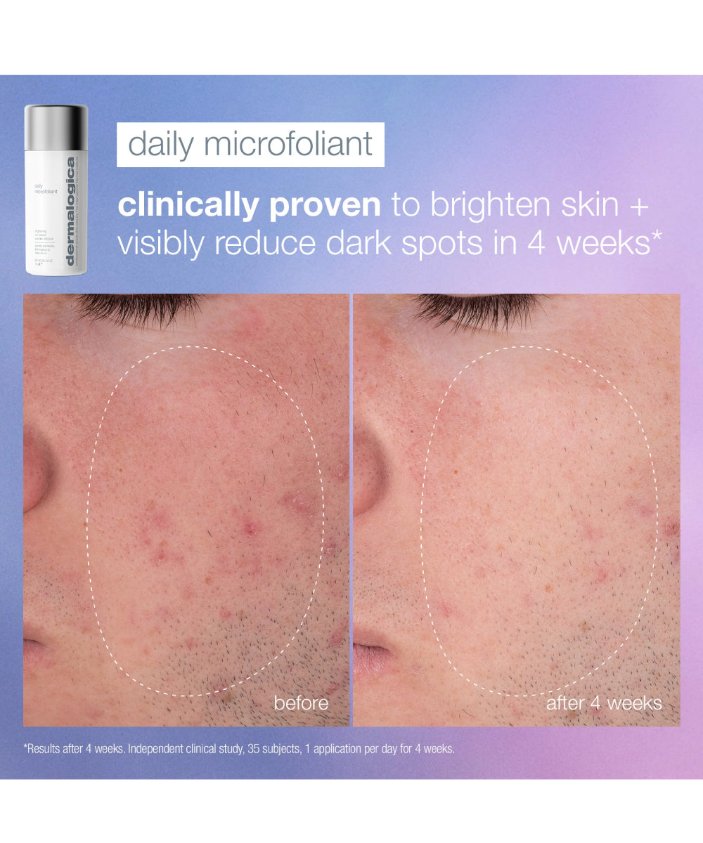 Pro Ritual: Exfoliate + Glow (1 Full-size + 2 Tools)