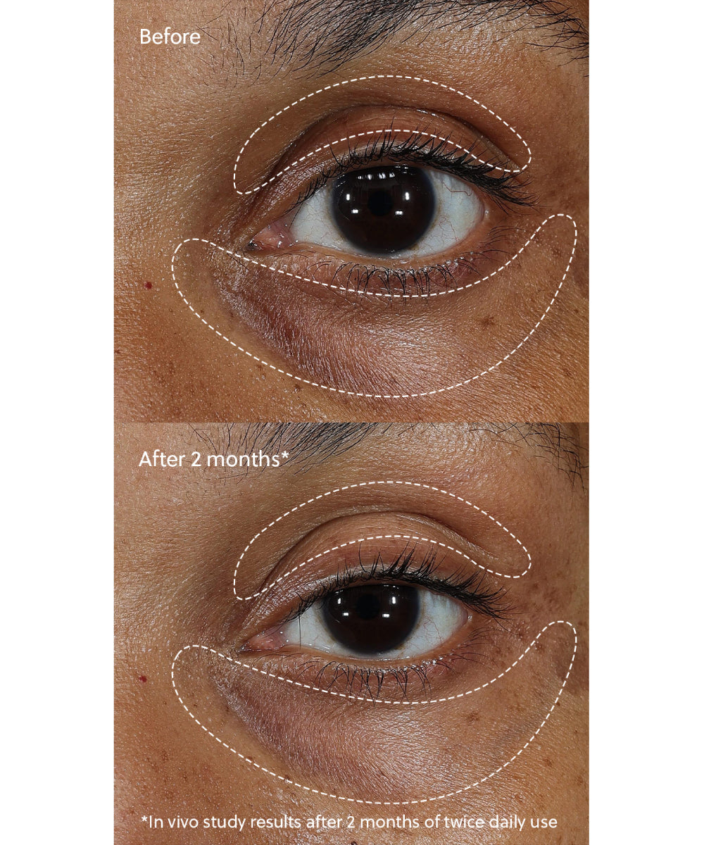 Vitamin C⁺ Eye Cream