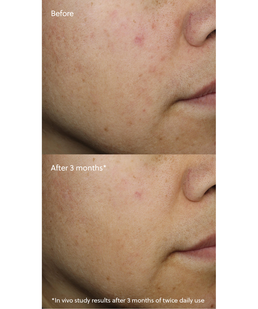 Vitamin C⁺ Serum