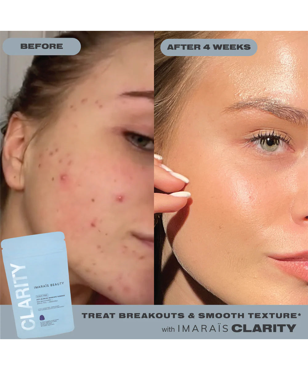 Clarity Skincare Gummies