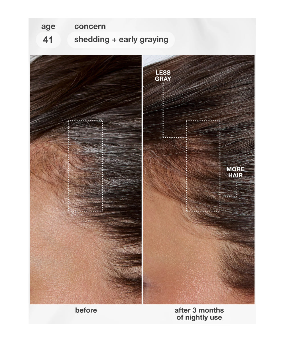 FutureIQ™ biomimetic hair longevity serum