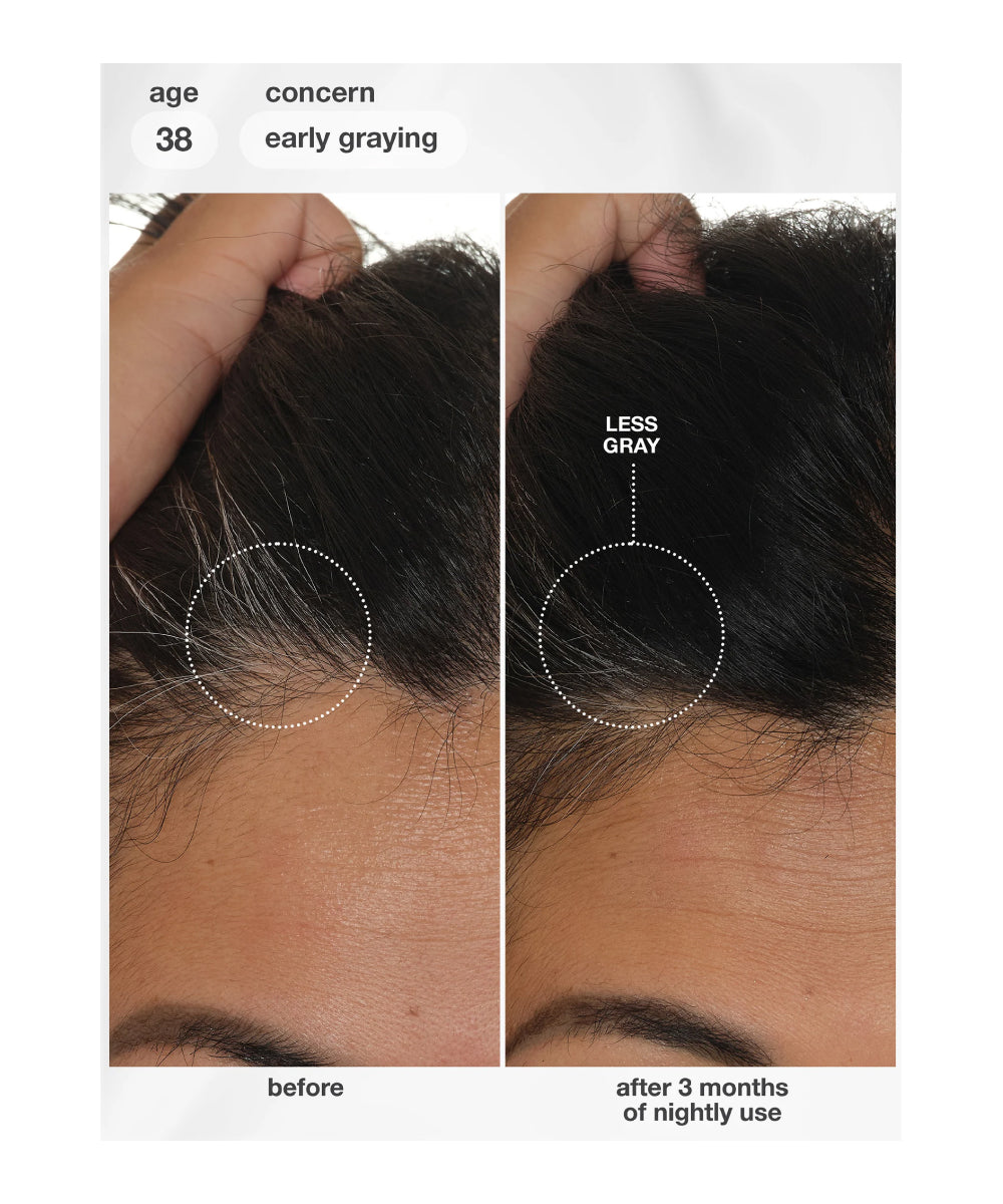 FutureIQ™ biomimetic hair longevity serum